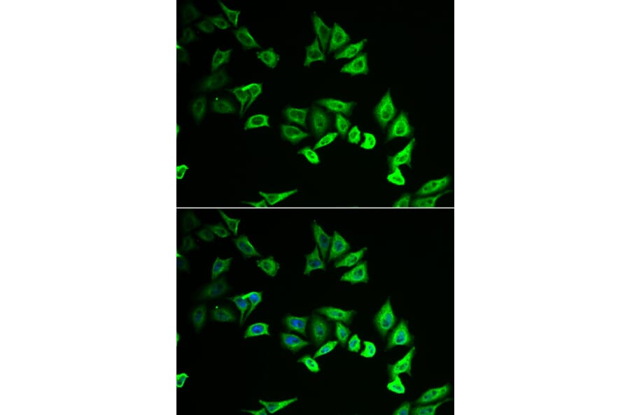 Anti-MYOZ2 Antibody from Bioworld Technology (BS8240) - Antibodies.com