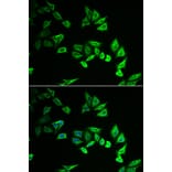 Anti-MYOZ2 Antibody from Bioworld Technology (BS8240) - Antibodies.com