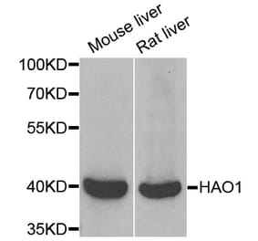 Anti-HAO1 Antibody from Bioworld Technology (BS8242) - Antibodies.com