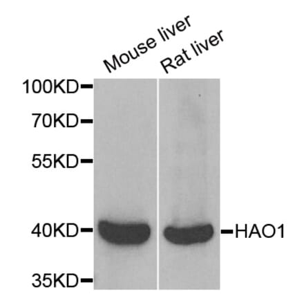 Anti-HAO1 Antibody from Bioworld Technology (BS8242) - Antibodies.com