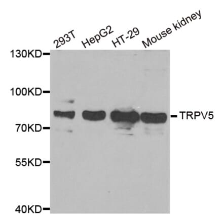 Anti-TRPV5 Antibody from Bioworld Technology (BS8245) - Antibodies.com