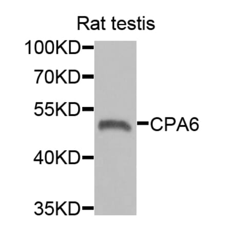 Anti-CPA6 Antibody from Bioworld Technology (BS8246) - Antibodies.com