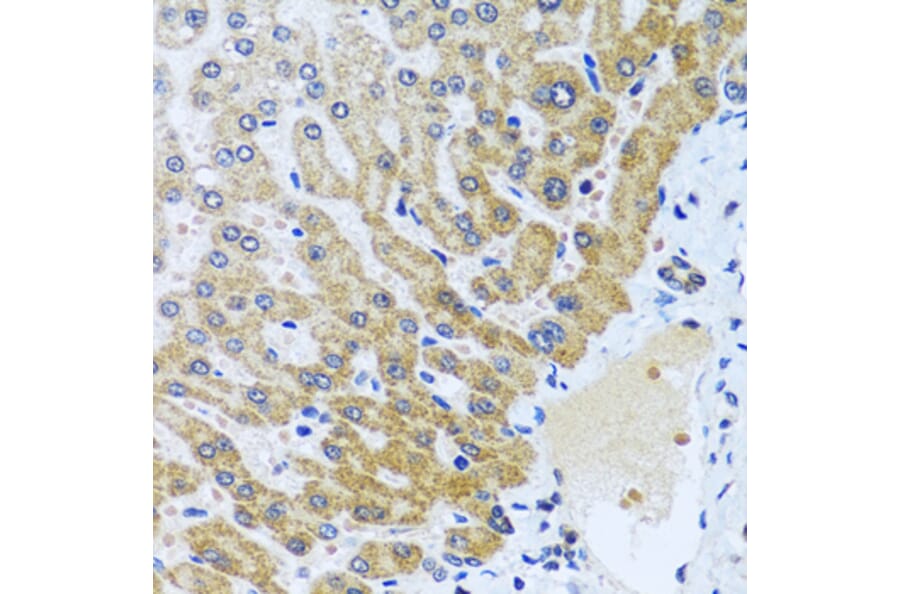 Anti-CPA6 Antibody from Bioworld Technology (BS8246) - Antibodies.com