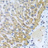 Anti-CPA6 Antibody from Bioworld Technology (BS8246) - Antibodies.com