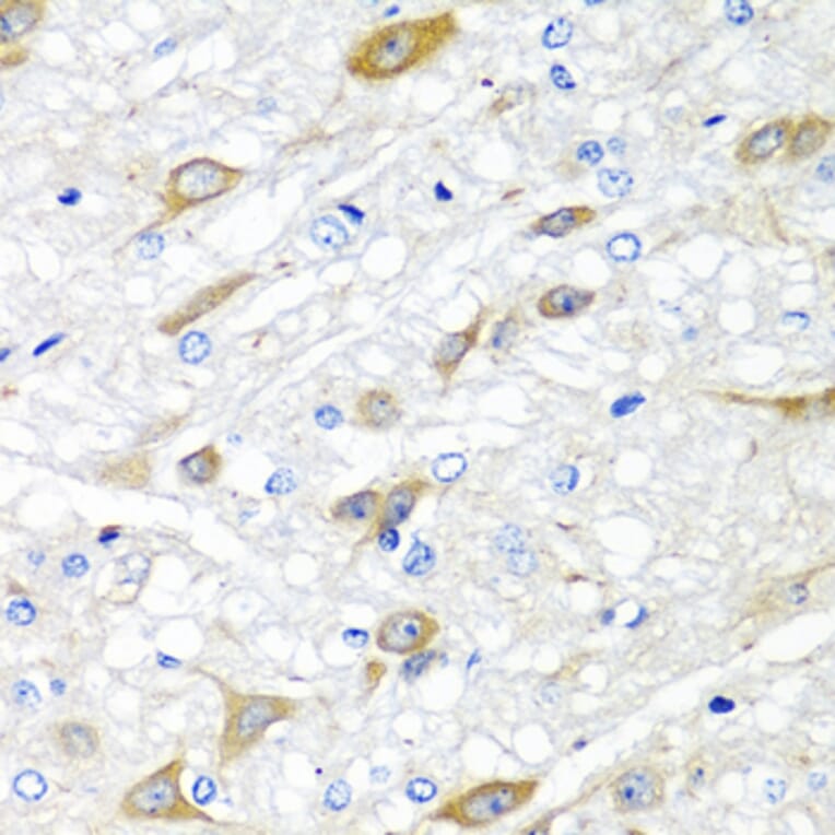 Anti-CPA6 Antibody from Bioworld Technology (BS8246) - Antibodies.com