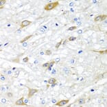 Anti-CPA6 Antibody from Bioworld Technology (BS8246) - Antibodies.com