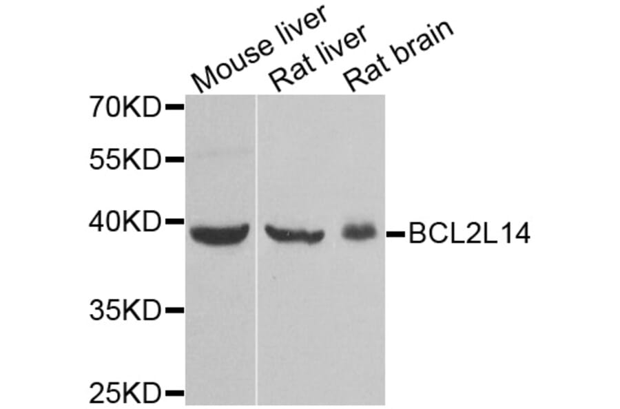 Anti-BCL2L14 Antibody from Bioworld Technology (BS8249) - Antibodies.com