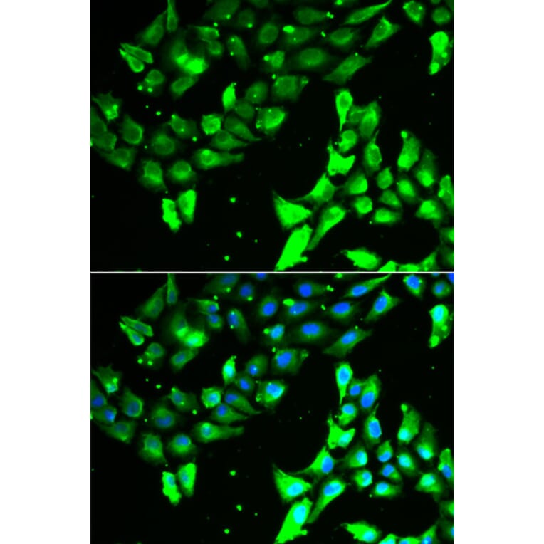 Anti-KIF2B Antibody from Bioworld Technology (BS8251) - Antibodies.com