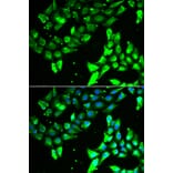 Anti-KIF2B Antibody from Bioworld Technology (BS8251) - Antibodies.com