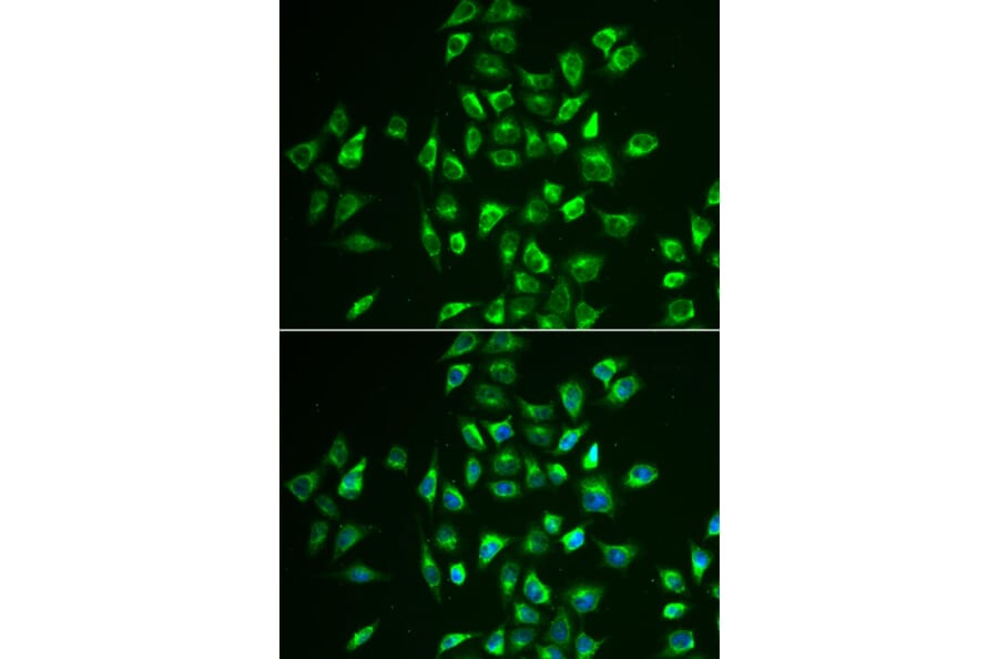 Anti-LNX1 Antibody from Bioworld Technology (BS8252) - Antibodies.com
