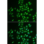 Anti-LNX1 Antibody from Bioworld Technology (BS8252) - Antibodies.com