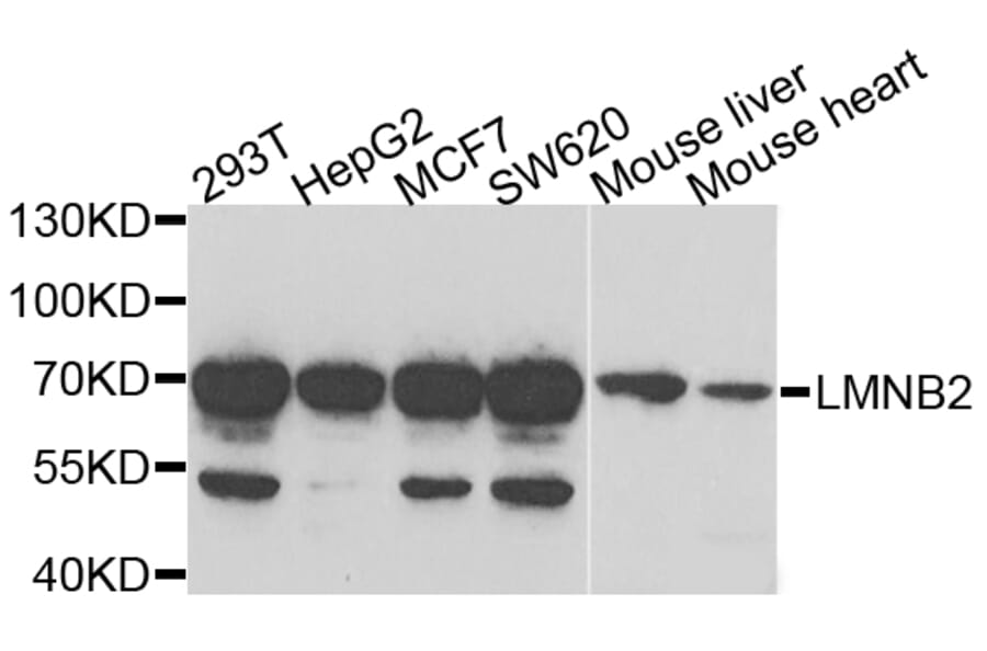 Anti-LMNB2 Antibody from Bioworld Technology (BS8254) - Antibodies.com