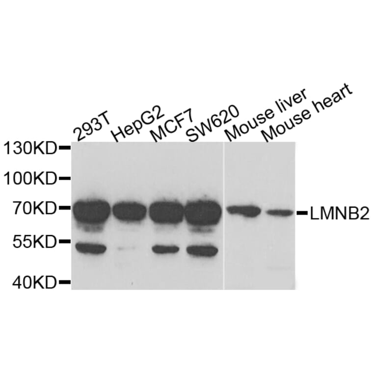 Anti-LMNB2 Antibody from Bioworld Technology (BS8254) - Antibodies.com