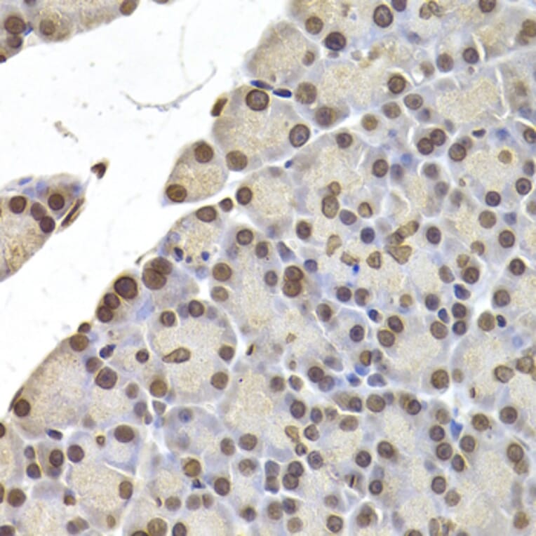 Anti-LMNB2 Antibody from Bioworld Technology (BS8254) - Antibodies.com