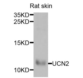Anti-UCN2 Antibody from Bioworld Technology (BS8256) - Antibodies.com
