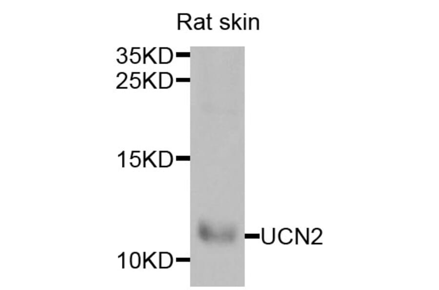 Anti-UCN2 Antibody from Bioworld Technology (BS8256) - Antibodies.com