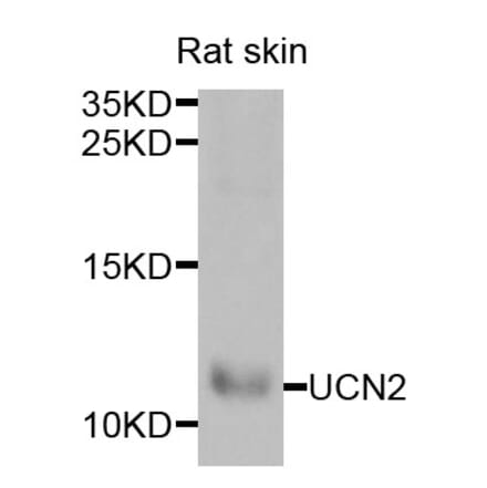 Anti-UCN2 Antibody from Bioworld Technology (BS8256) - Antibodies.com