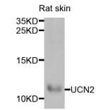 Anti-UCN2 Antibody from Bioworld Technology (BS8256) - Antibodies.com