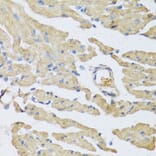 Anti-UCN2 Antibody from Bioworld Technology (BS8256) - Antibodies.com