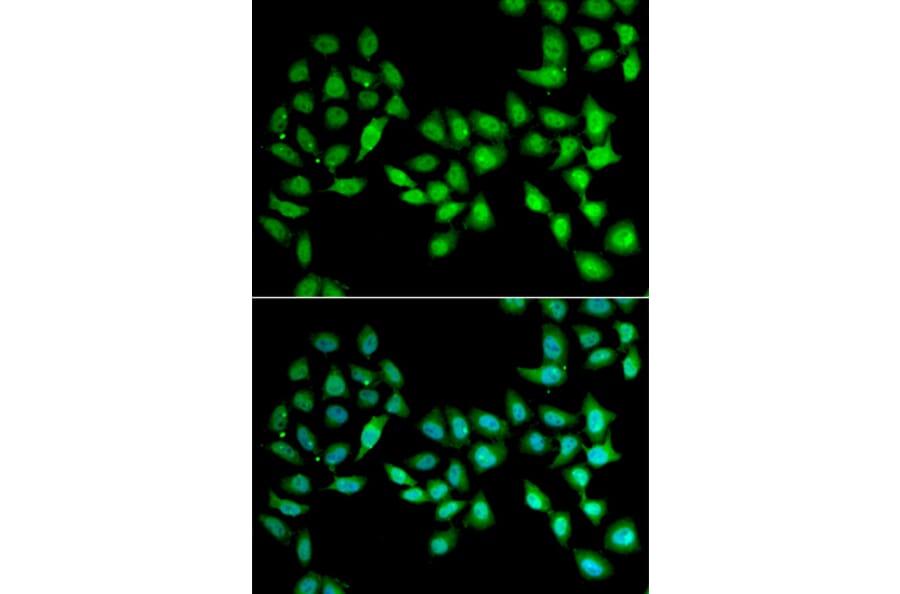 Anti-UCN2 Antibody from Bioworld Technology (BS8256) - Antibodies.com