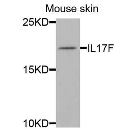 Anti-IL17F Antibody from Bioworld Technology (BS8257) - Antibodies.com