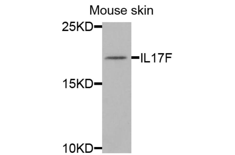 Anti-IL17F Antibody from Bioworld Technology (BS8257) - Antibodies.com