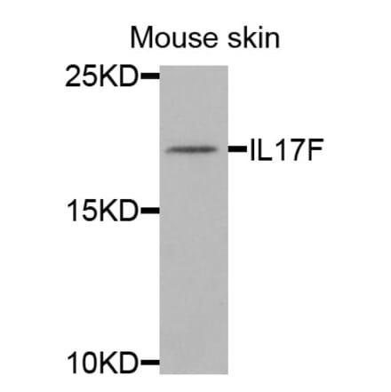 Anti-IL17F Antibody from Bioworld Technology (BS8257) - Antibodies.com