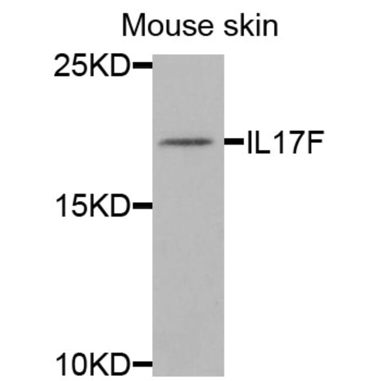 Anti-IL17F Antibody from Bioworld Technology (BS8257) - Antibodies.com