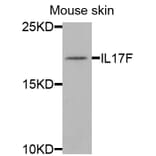 Anti-IL17F Antibody from Bioworld Technology (BS8257) - Antibodies.com