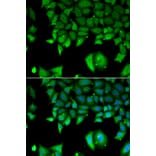 Anti-IL17F Antibody from Bioworld Technology (BS8257) - Antibodies.com