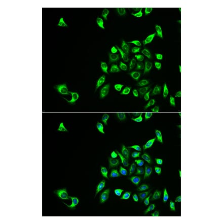 Anti-CSNK1A1L Antibody from Bioworld Technology (BS8259) - Antibodies.com