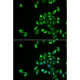 Anti-CSNK1A1L Antibody from Bioworld Technology (BS8259) - Antibodies.com