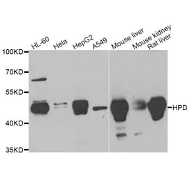 Anti-HPD Antibody from Bioworld Technology (BS8265) - Antibodies.com