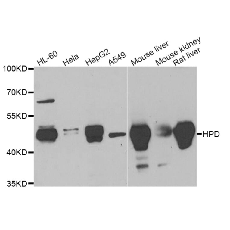 Anti-HPD Antibody from Bioworld Technology (BS8265) - Antibodies.com