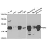 Anti-HPD Antibody from Bioworld Technology (BS8265) - Antibodies.com