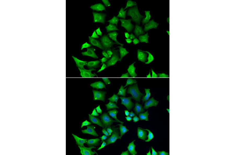Anti-ENTPD2 Antibody from Bioworld Technology (BS8268) - Antibodies.com