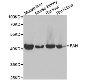 Anti-FAH Antibody from Bioworld Technology (BS8270) - Antibodies.com