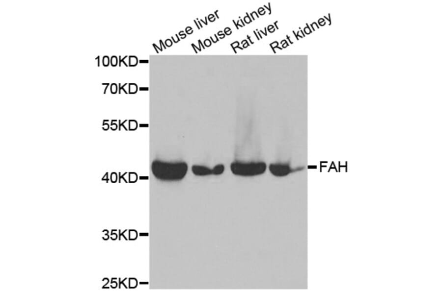 Anti-FAH Antibody from Bioworld Technology (BS8270) - Antibodies.com