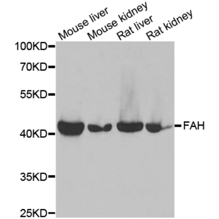 Anti-FAH Antibody from Bioworld Technology (BS8270) - Antibodies.com