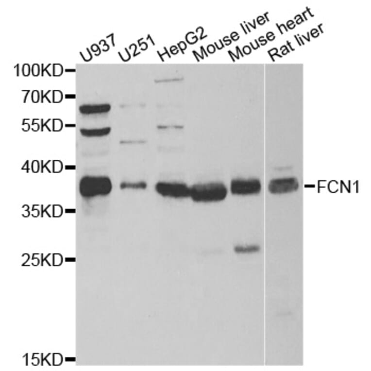 Anti-FCN1 Antibody from Bioworld Technology (BS8271) - Antibodies.com