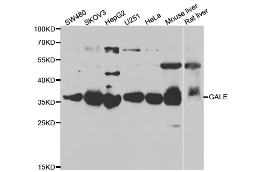Anti-GALE Antibody from Bioworld Technology (BS8279) - Antibodies.com