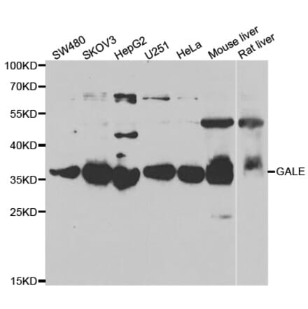 Anti-GALE Antibody from Bioworld Technology (BS8279) - Antibodies.com