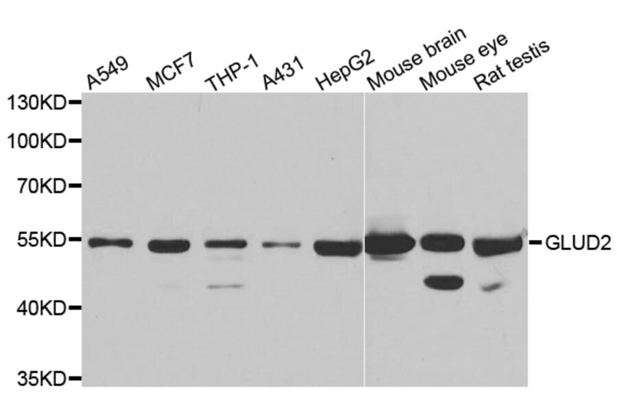 Anti-GLUD2 Antibody from Bioworld Technology (BS8288) - Antibodies.com