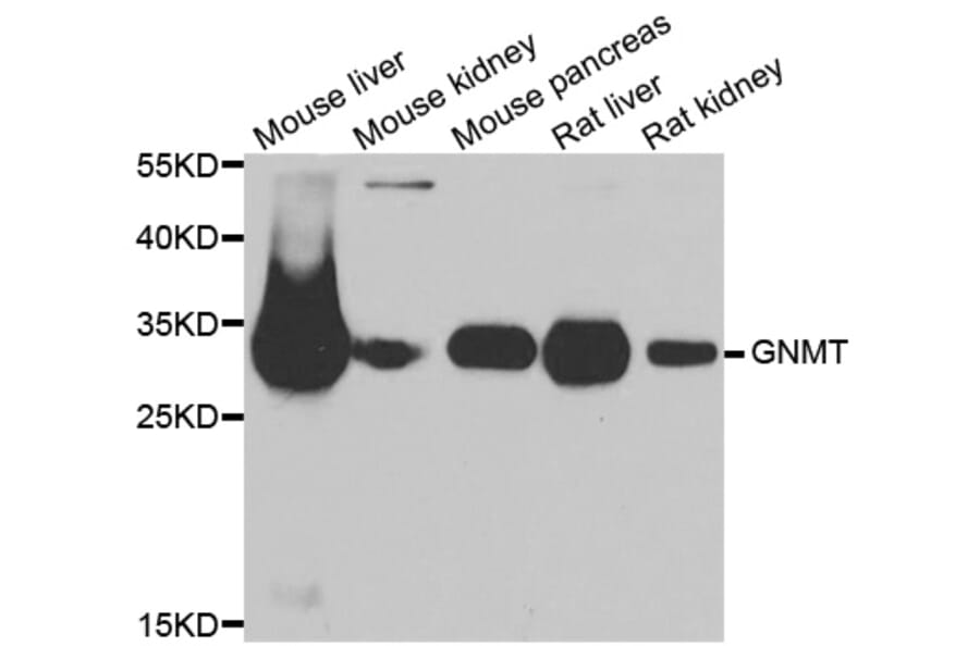 Anti-GNMT Antibody from Bioworld Technology (BS8292) - Antibodies.com