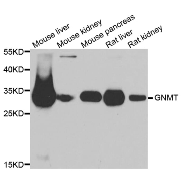 Anti-GNMT Antibody from Bioworld Technology (BS8292) - Antibodies.com