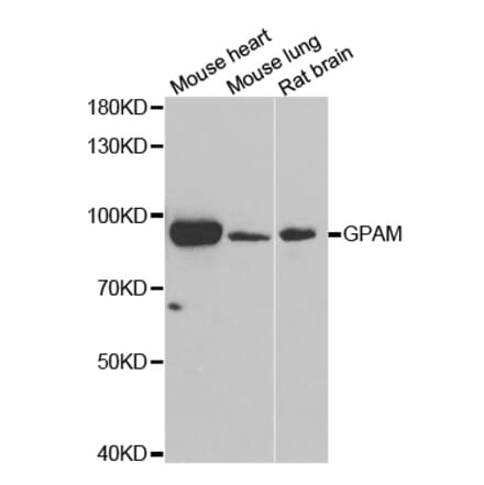 Anti-GPAM Antibody from Bioworld Technology (BS8294) - Antibodies.com