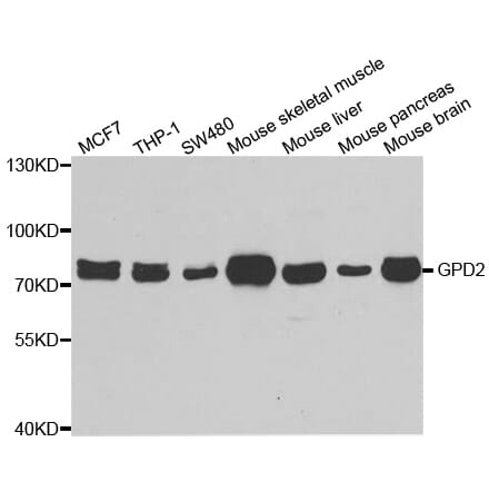 Anti-GPD2 Antibody from Bioworld Technology (BS8295) - Antibodies.com