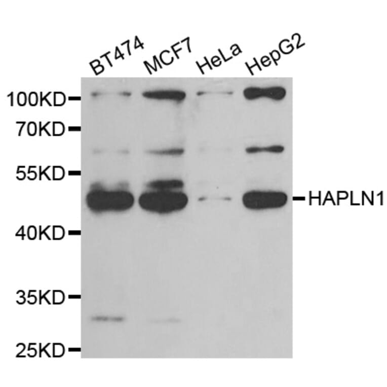 Anti-HAPLN1 Antibody from Bioworld Technology (BS8297) - Antibodies.com
