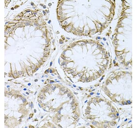 Anti-HPS1 Antibody from Bioworld Technology (BS8302) - Antibodies.com