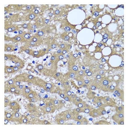 Anti-HYAL1 Antibody from Bioworld Technology (BS8303) - Antibodies.com